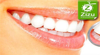 Суперсовременное фотоотбеливание зубов профессиональным гелем в РИГЕ или ЮРМАЛЕ со скидкой -40%. НЕ ПЛАТИ ВСЕ СРАЗУ!