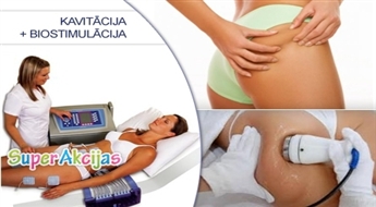 Kavitācija + biostimulācija (limfodrenāža) ar Ultratone ideālai figūrai kabinetā MONA BEAUTY!