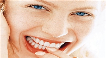 Izmanto izdevību un iegūsti skaistus, veselus zobus! Zobu labošana klīnikā "Horta" par 50% lētāk!