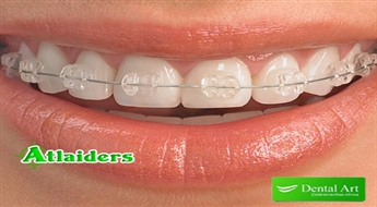 Parūpējieties par zobu skaistumu un veselību! Ortodonta konsultācija klīnikā „Dental Art” ar 51% atlaidi – tagad tikai par 4,90 Ls!