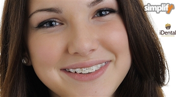 iDental: Kонсультация ортодонта