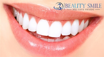 Par 2-8 toņiem gaišāki zobi 1 h laikā! Saudzīga zobu balināšanas procedūra kosmetoloģijas kabinetā Beauty Smile – 57%