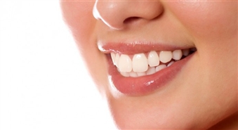 Uzsmaidi pavasarim! Zobu un mutes dobuma higiēna ar atlaidi 63% un 30% atlaide uz turpmāko ārstēšanu klīnikā Horta!
