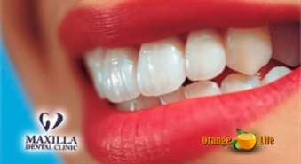 Lai Tavs smaids būtu neaizmirstams! Profesionāla mutes dobuma higiēna no «Maxilla dental clinic» ar atlaidi 43%, tikai par 19,90 LVL