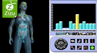 PAPILDU KUPONI: Pilna visa organisma 3D-izmeklēšana ar datoru – 50% atlaide. Kontrolējiet potenciālās slimības!