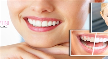 Profesionālā zobu fotobalināšana ar 41% atlaidi. NEMAKSĀ VISU UZREIZ!