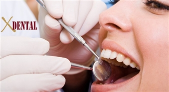 City karte, kas nodrošina 50% atlaidi zobu labošanai un higiēnista apmeklējumam zobārstniecības klīnikā X-DENTAL!