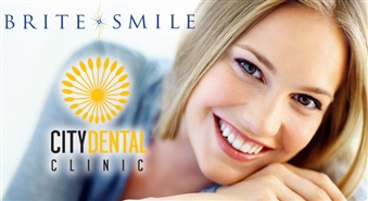 Zobārstniecības klīnika CITYDENTAL piedāvā: zobu balināšana ar ekskluzīvo BriteSmile tehnoloģiju par 44% lētāk!