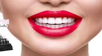 Kompozīta venīru „Uveneer” uzstādīšana zobu formas un krāsas korekcijai ar 40% atlaidi. NEMAKSĀ VISU UZREIZ!