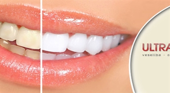 „ULTRAMEDS-K”: Zobu fotobalināšana ar 48% atlaidi. NEMAKSĀ VISU UZREIZ!