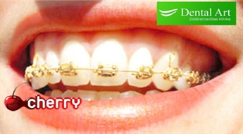 Dental Art: safīra vai zelta breketes ar 15% atlaidi, iegādājoties ortodonta konsultāciju un žokļa panorāmas rentgena uzņēmumu -65%