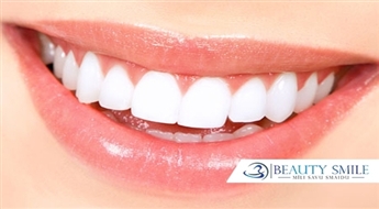 Par 2-8 toņiem gaišāki zobi 1 h laikā! Saudzīga zobu balināšana kosmetoloģijas kabinetā Beauty Smile -57%