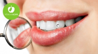 Засияй! Украшение зуба от "Swarovsky" - полировка зуба и прикрепление украшения выбранного размера